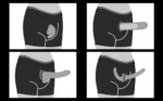 Ingen Cueca Boxer para Fixação de Packer - Imagem 18